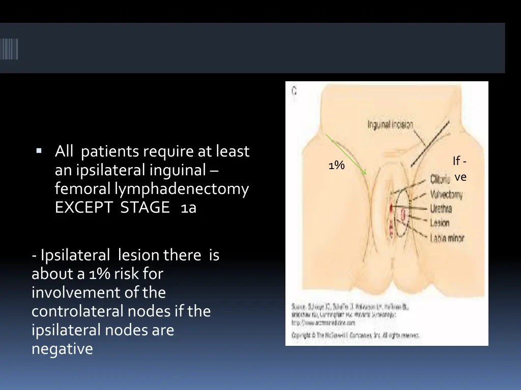 all patients require at least an ipsilateral