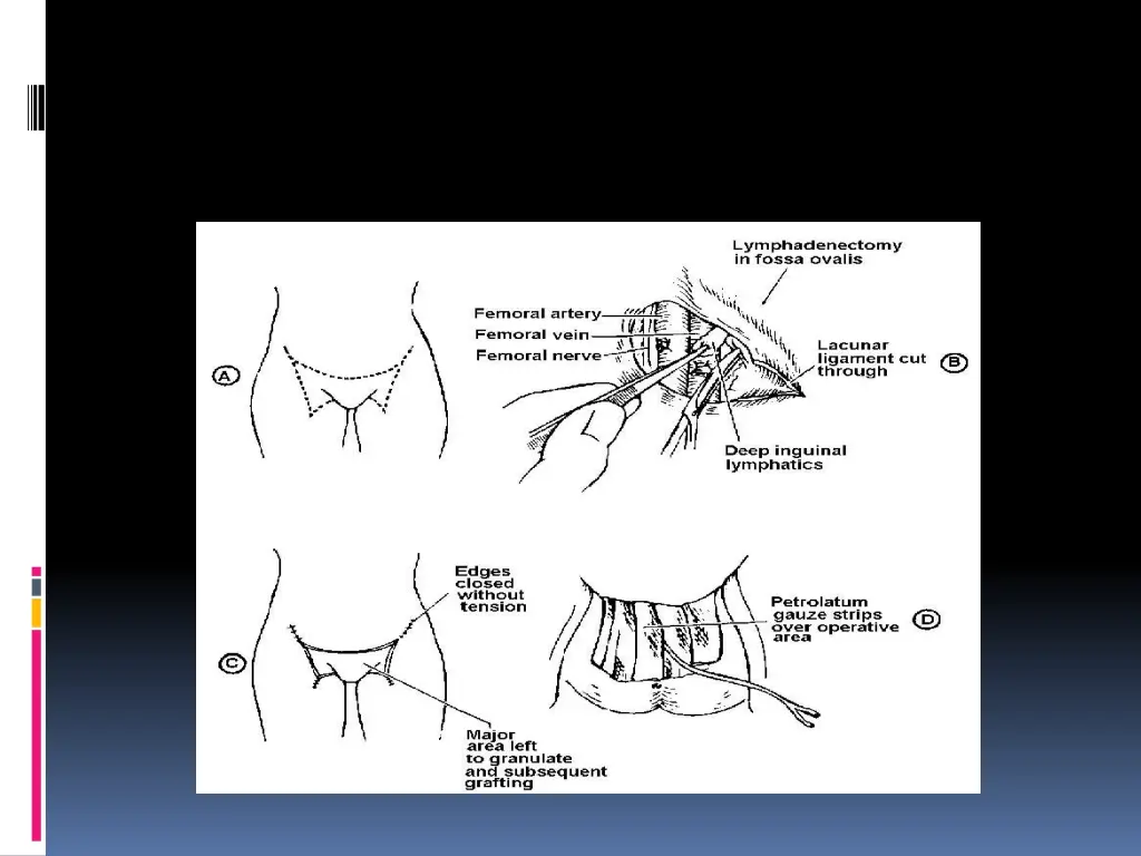 slide12