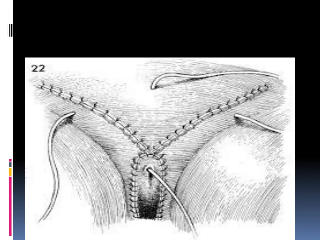 slide15