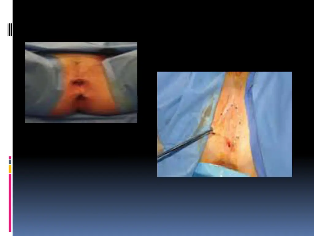 slide17