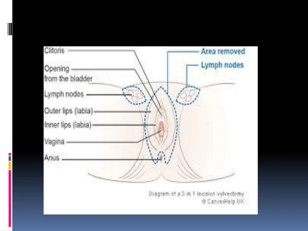 slide20