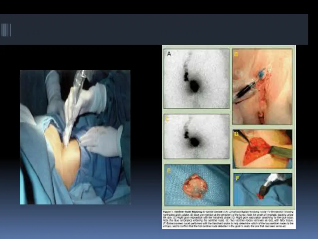 slide22