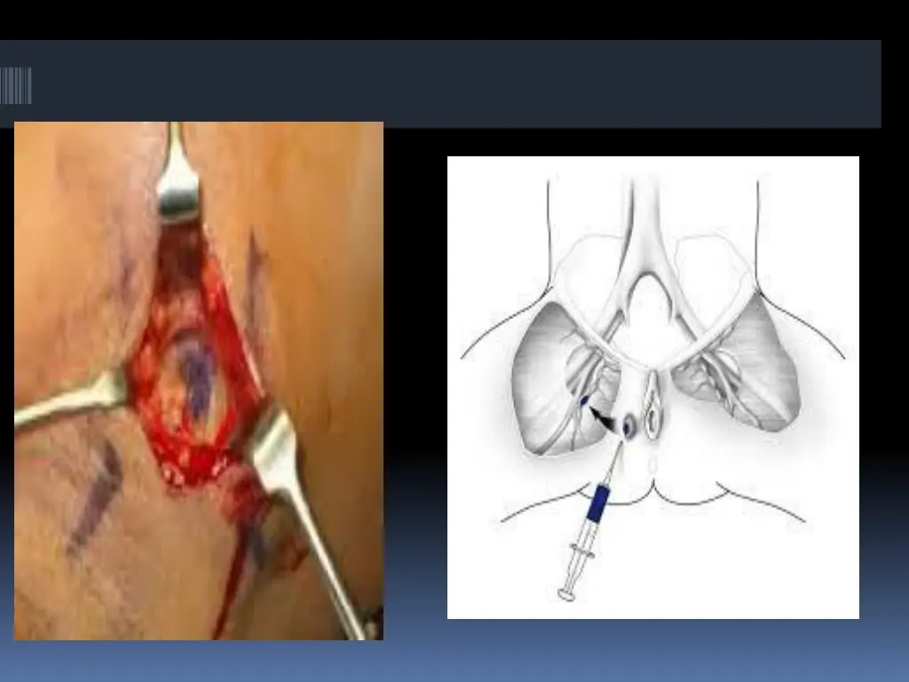 slide23
