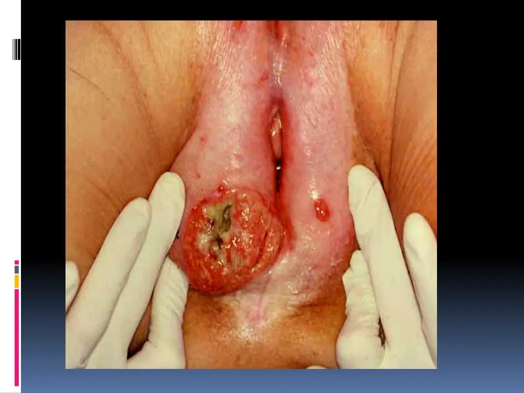 slide4