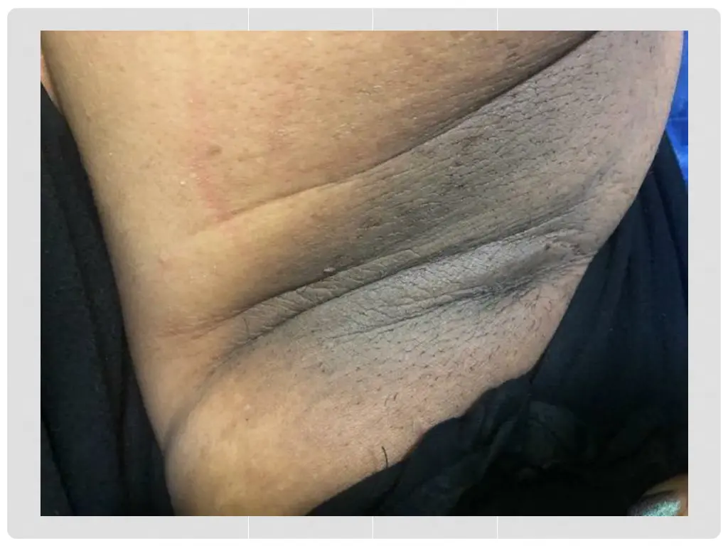 slide17