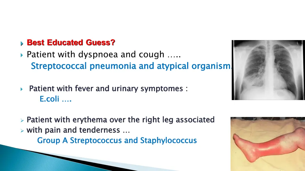 best educated guess patient with dyspnoea