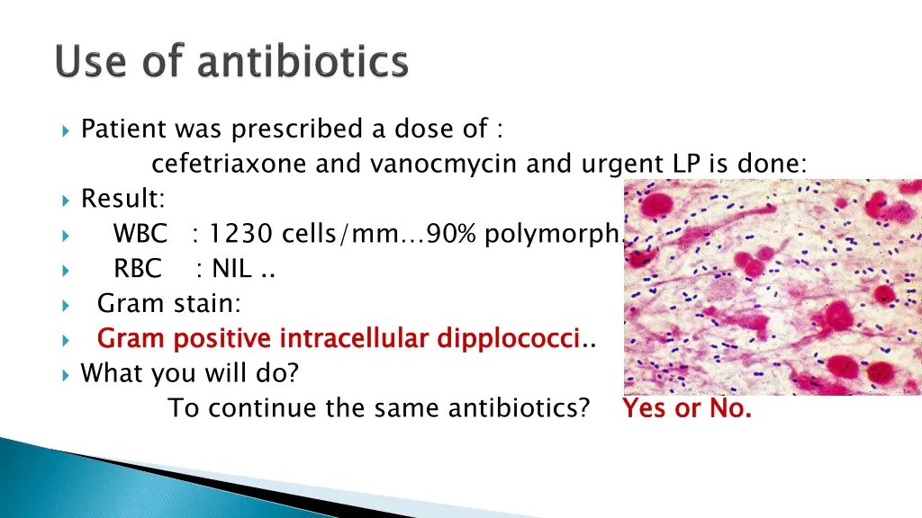 patient was prescribed a dose of cefetriaxone