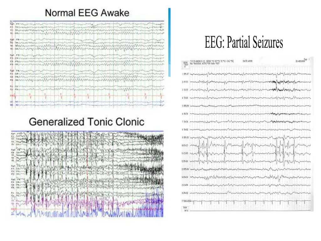 slide26