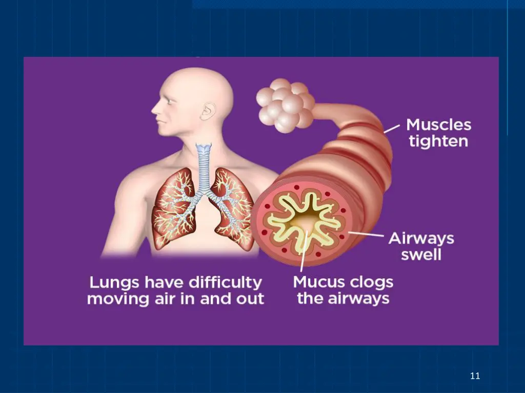 slide11