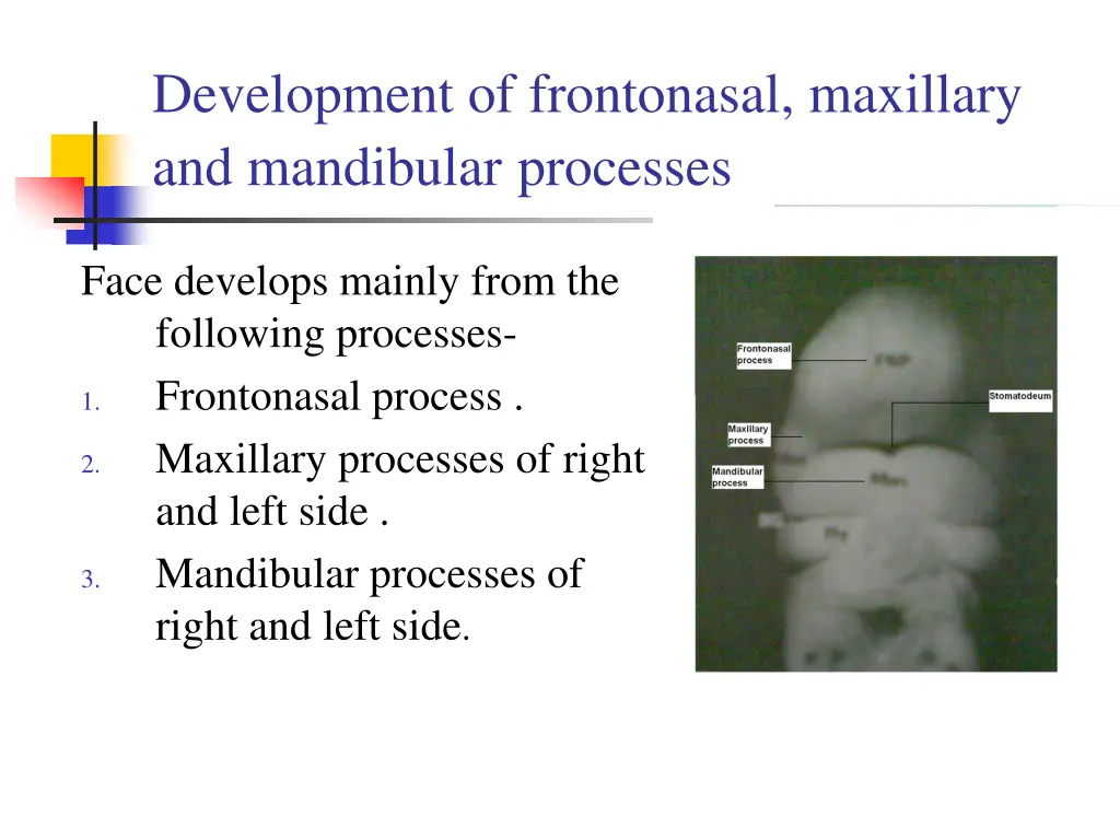 development of frontonasal maxillary