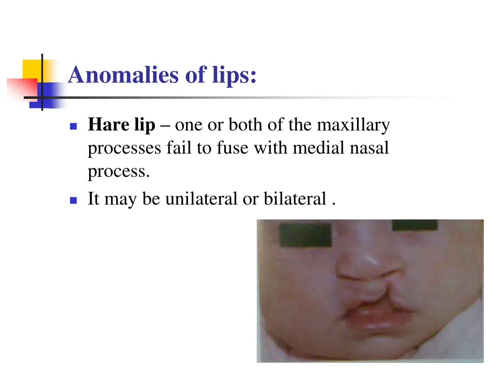anomalies of lips