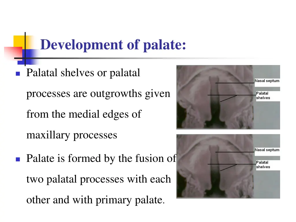 development of palate