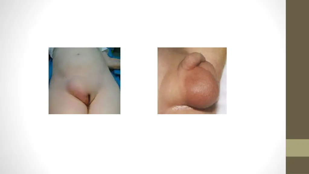 slide2
