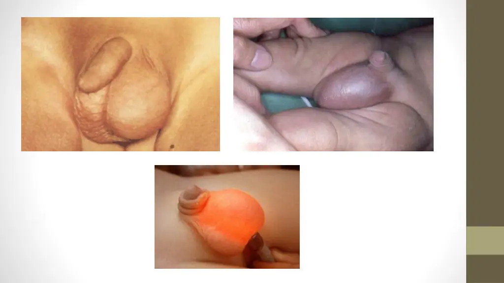 slide22