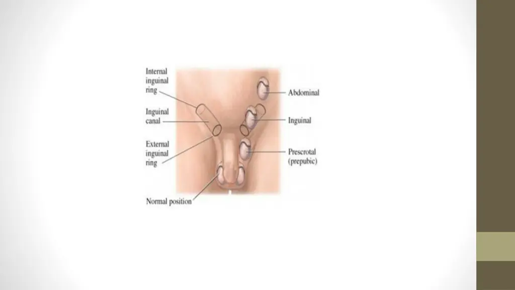 slide28