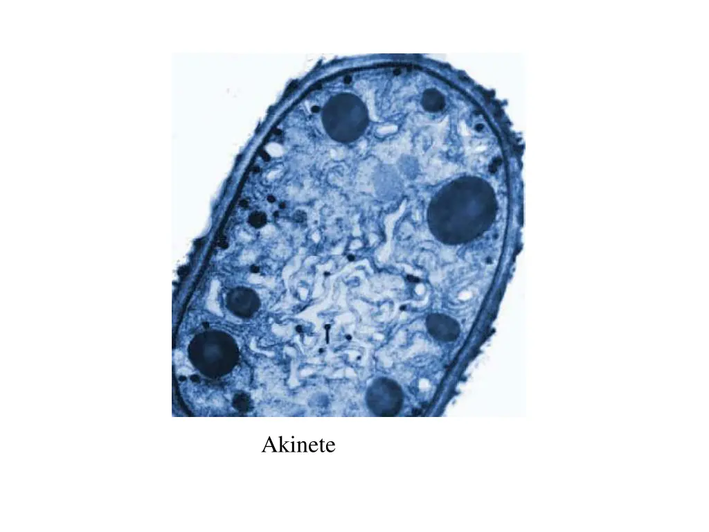 akinete
