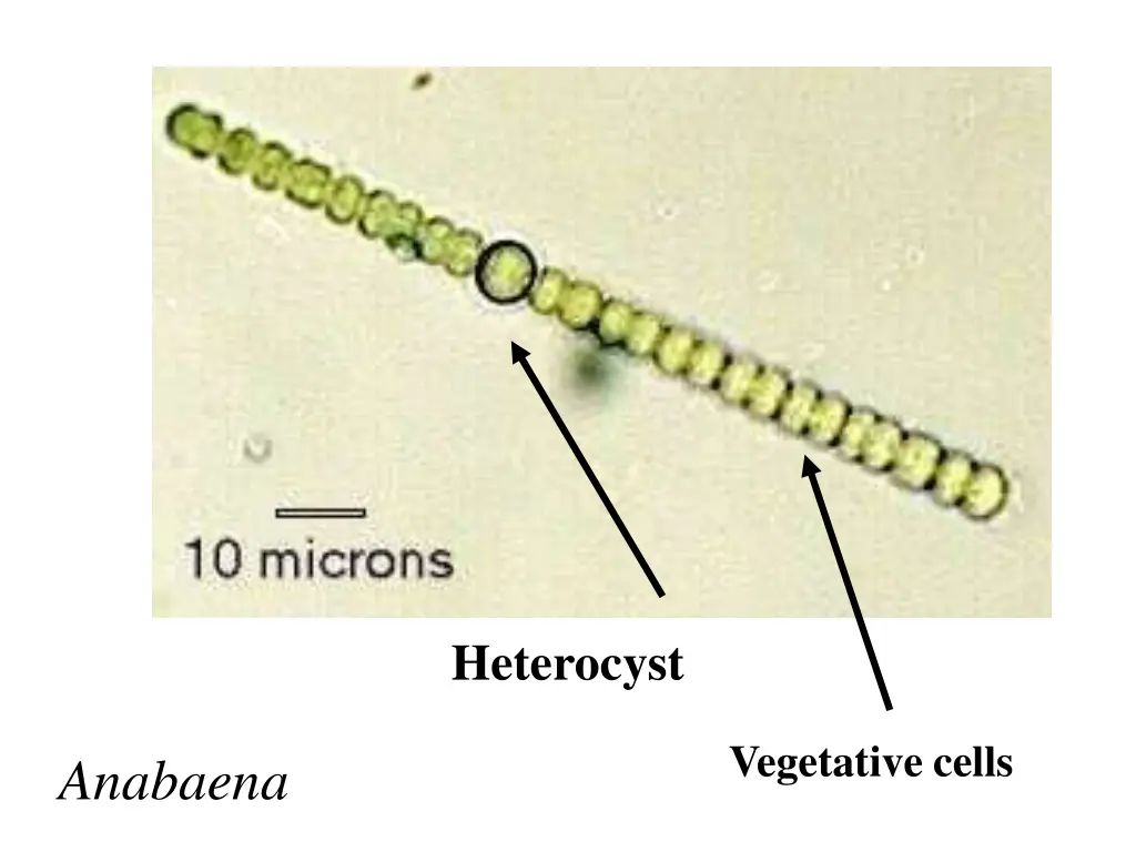 heterocyst