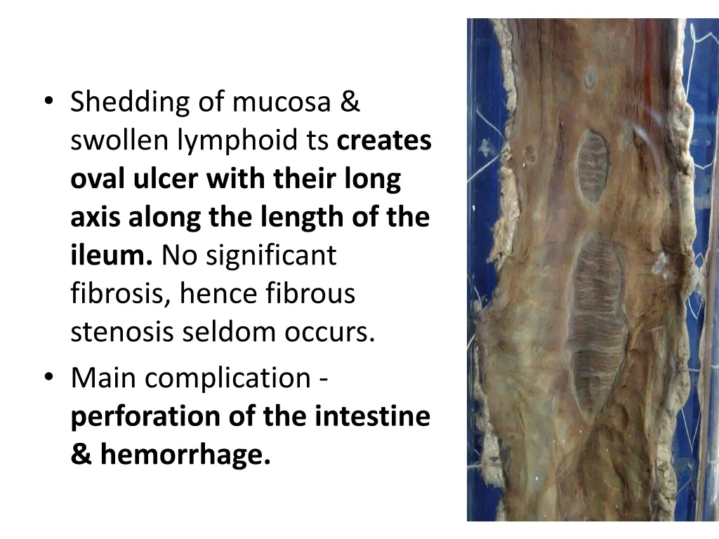 shedding of mucosa swollen lymphoid ts creates