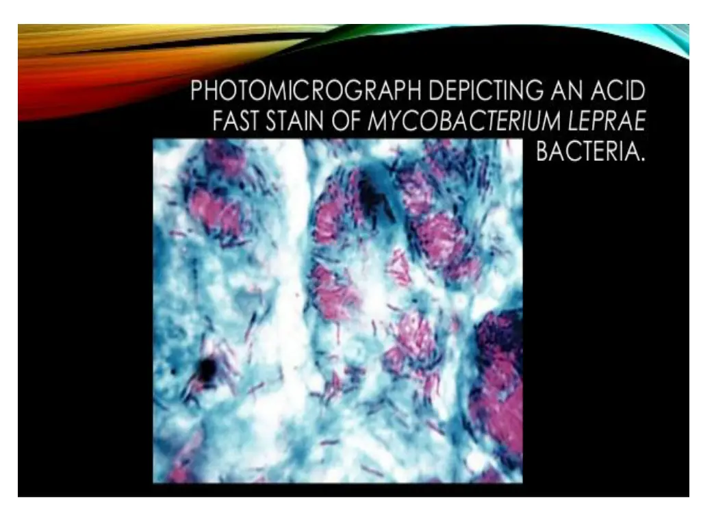 slide35