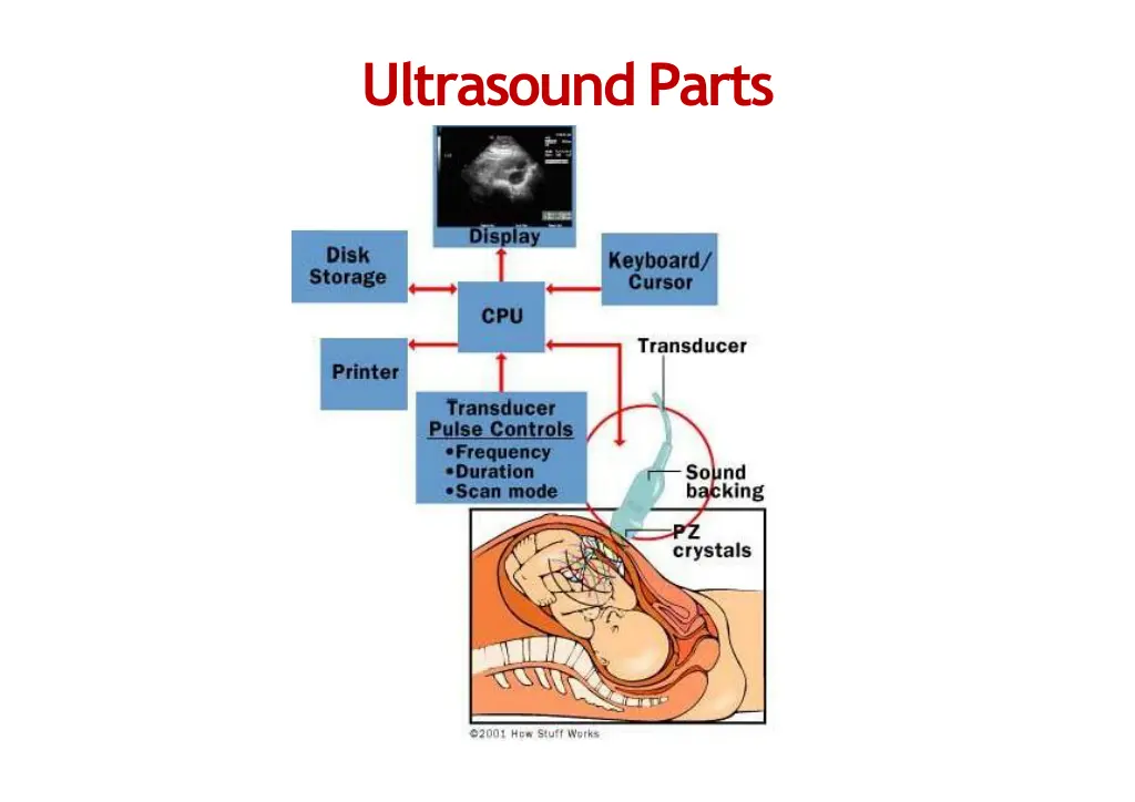 ultrasoundparts