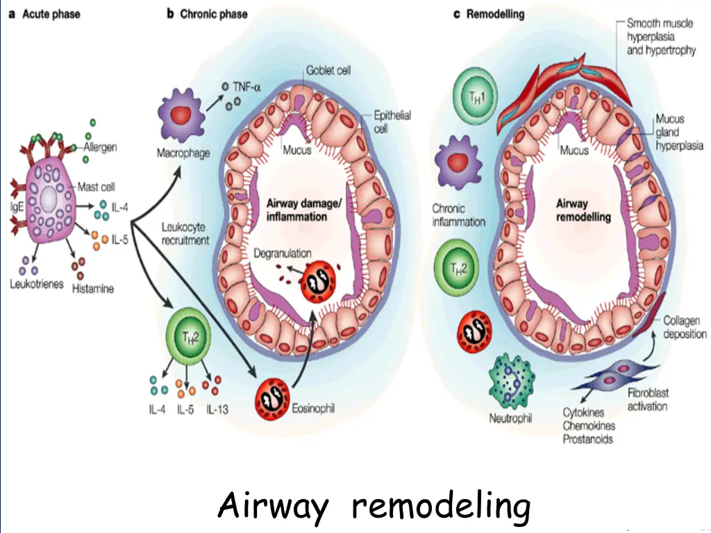 airway remodeling