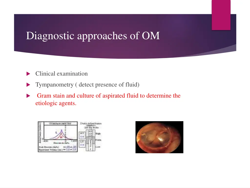 diagnostic approaches of om