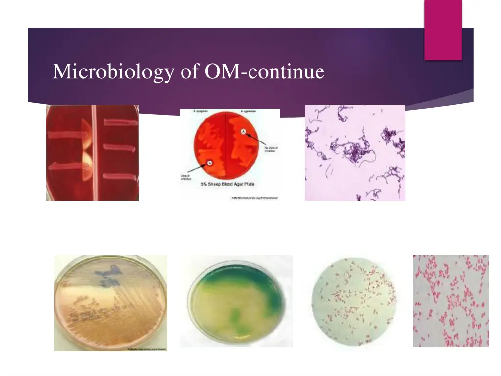 microbiology of om continue