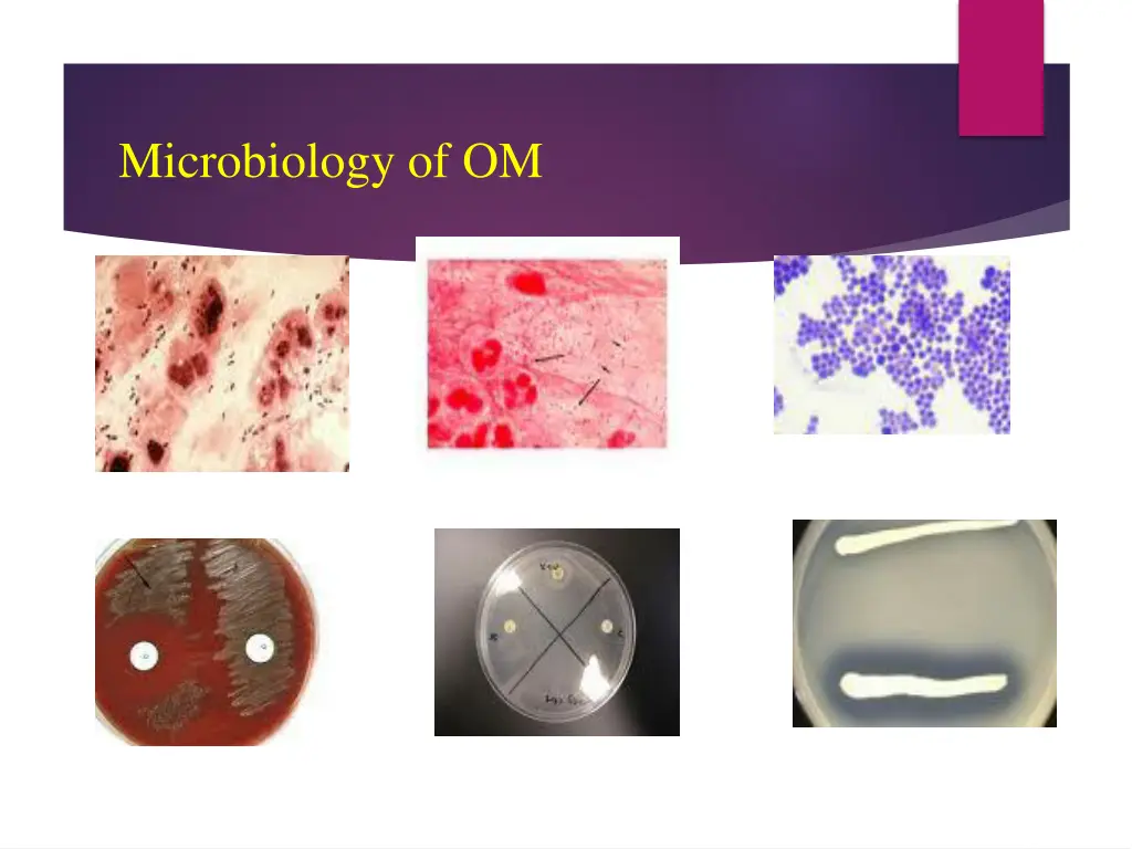 microbiology of om