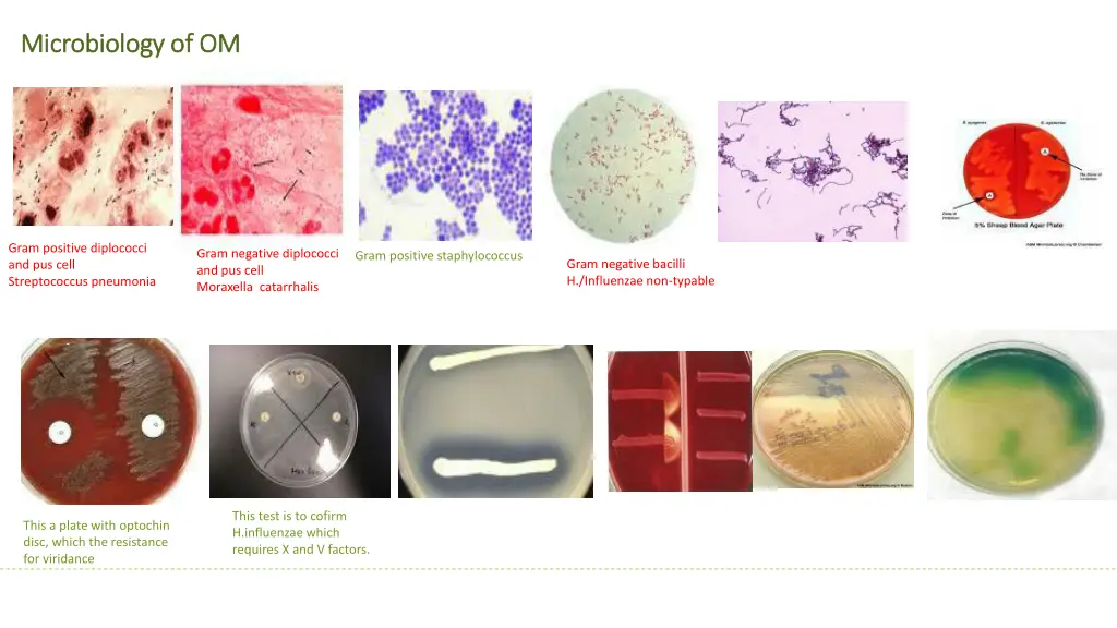 microbiology of om microbiology of om