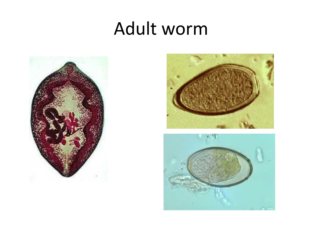 adult worm 1