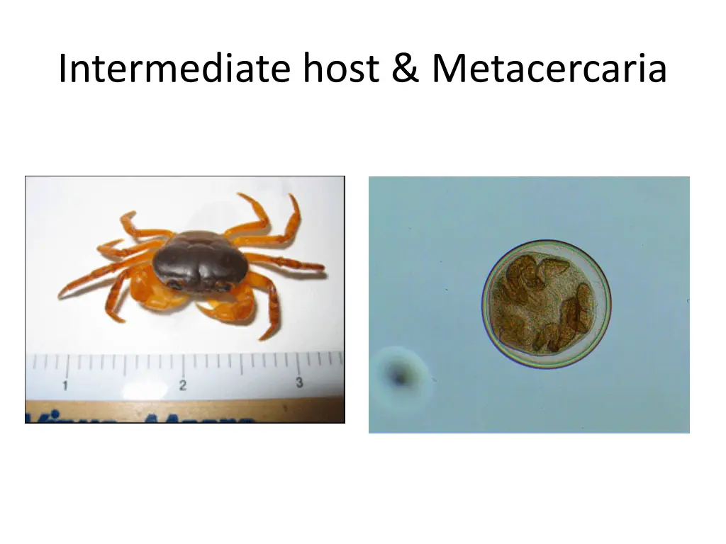 intermediate host metacercaria