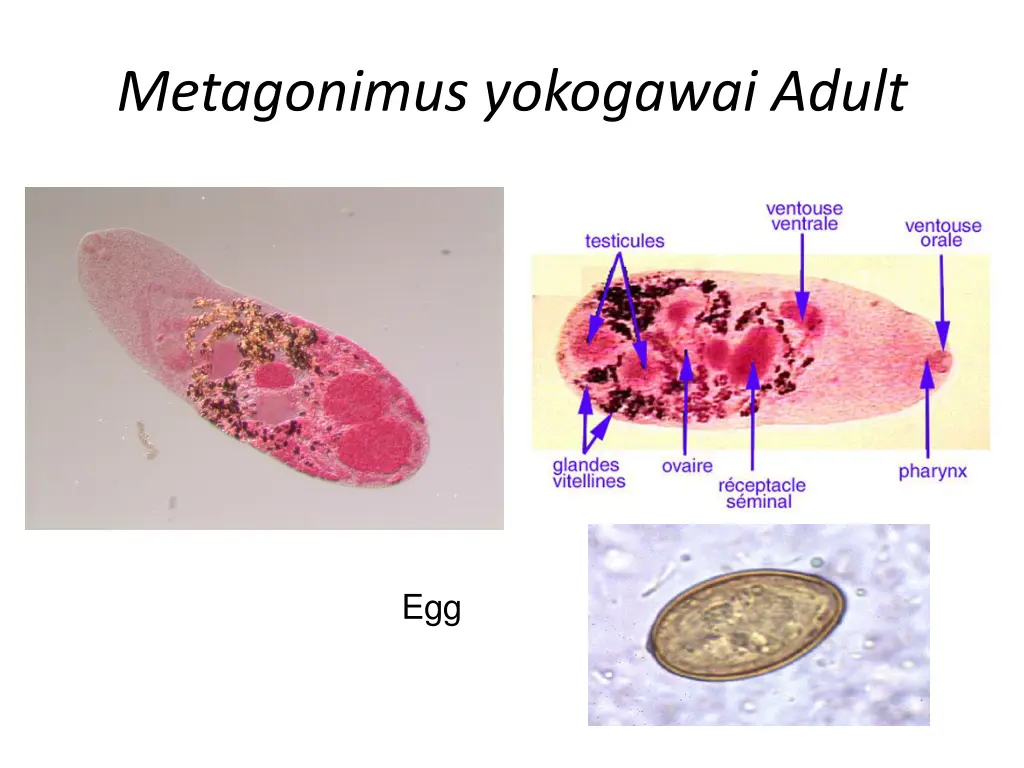 metagonimus yokogawai adult