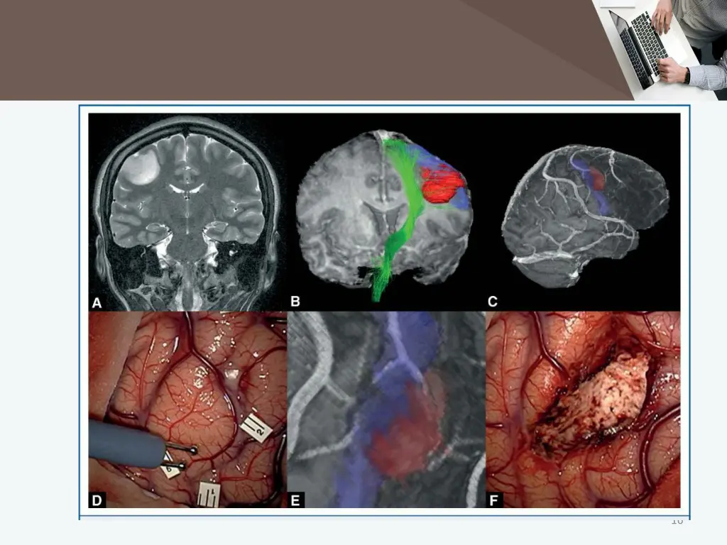 slide16