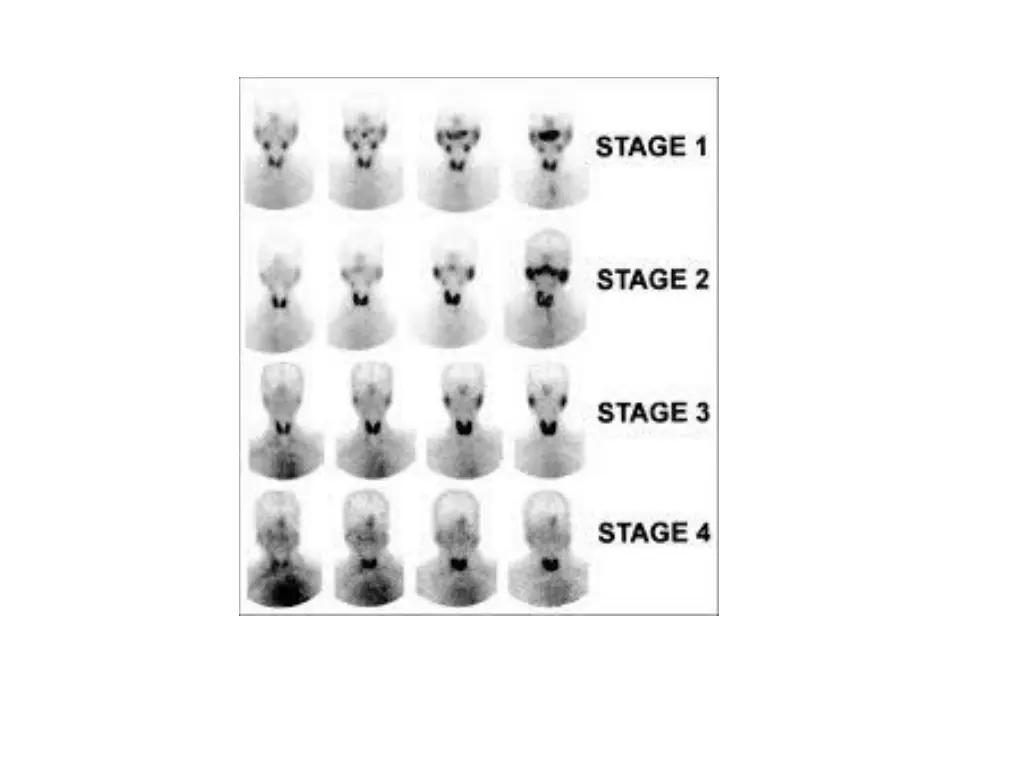 slide15