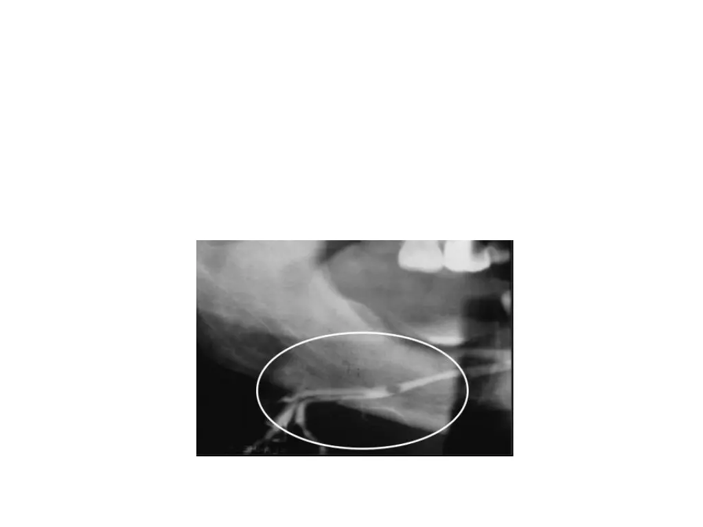 slide21