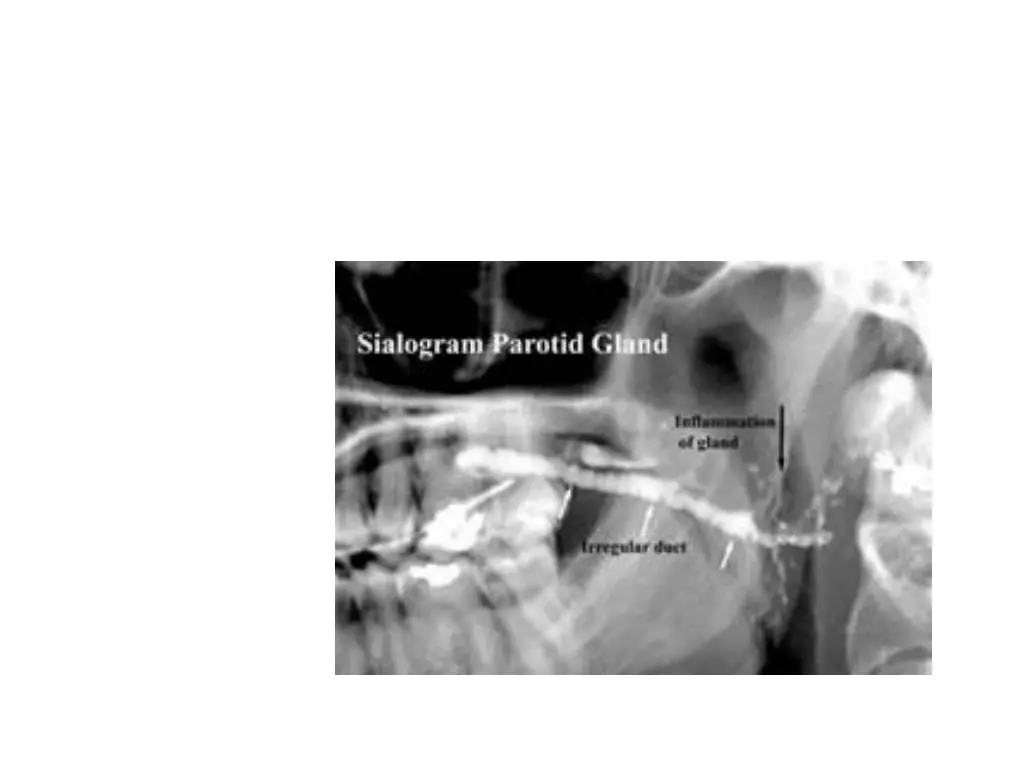 slide24