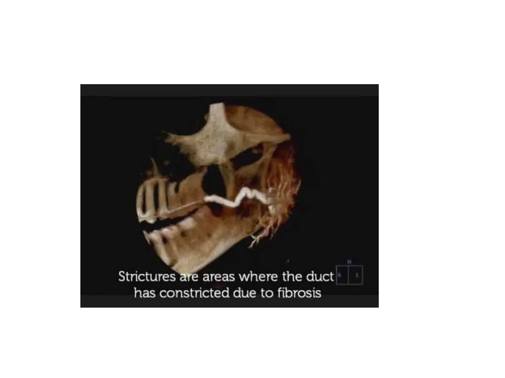 slide26
