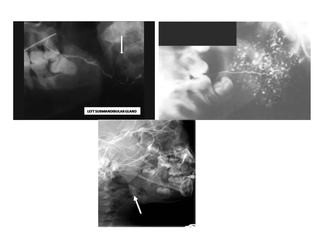 slide30