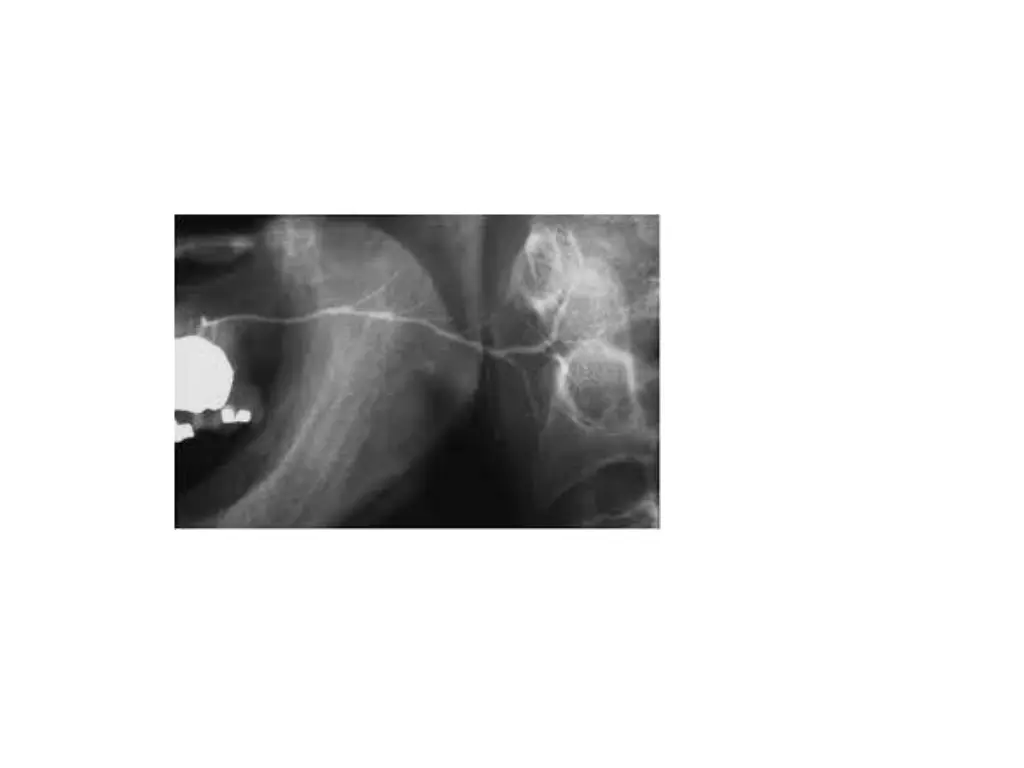 slide36