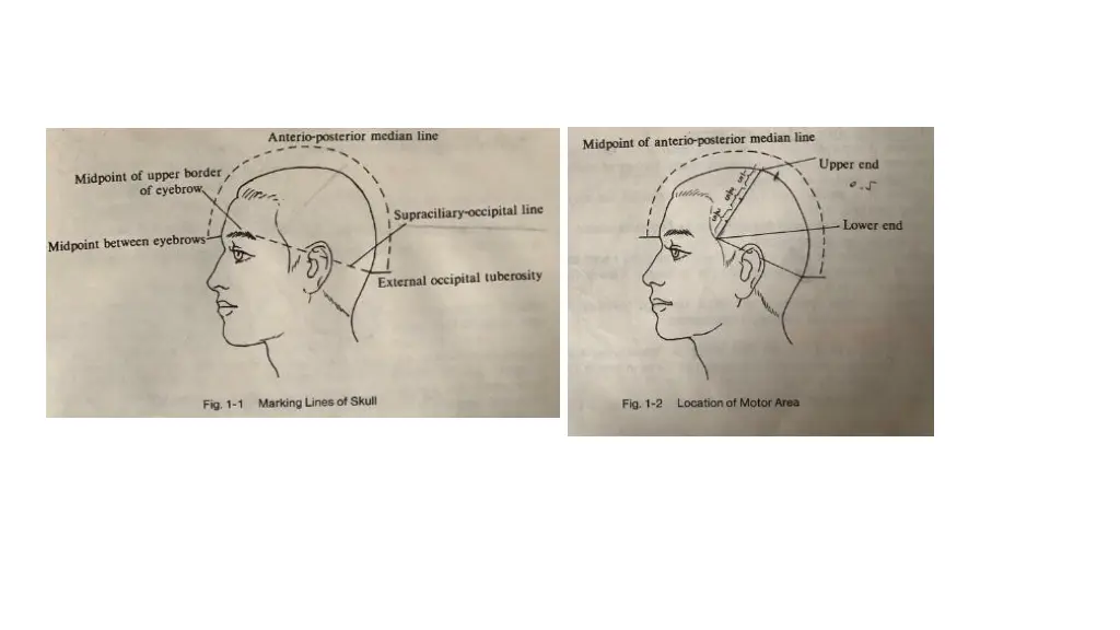 slide13