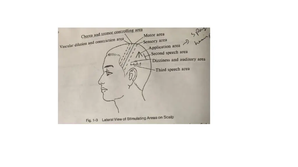 slide15