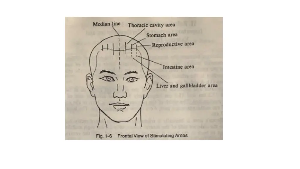 slide33