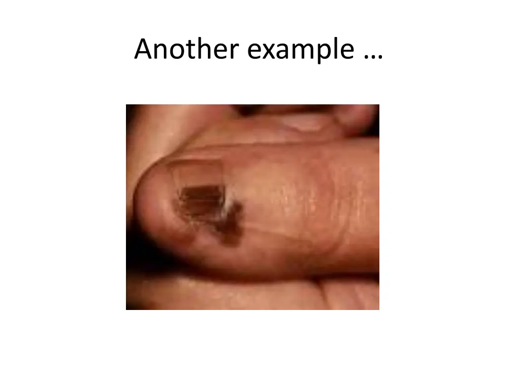 another example