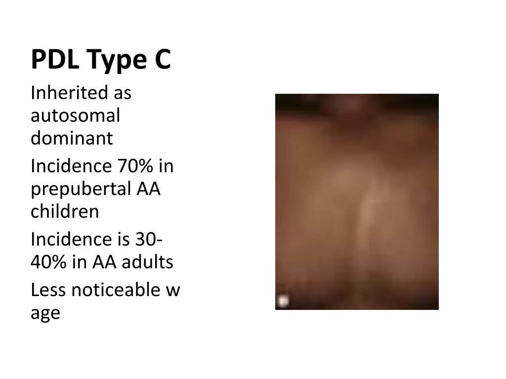 pdl type c inherited as autosomal dominant