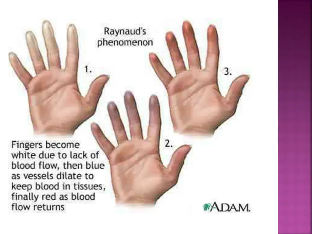 slide3