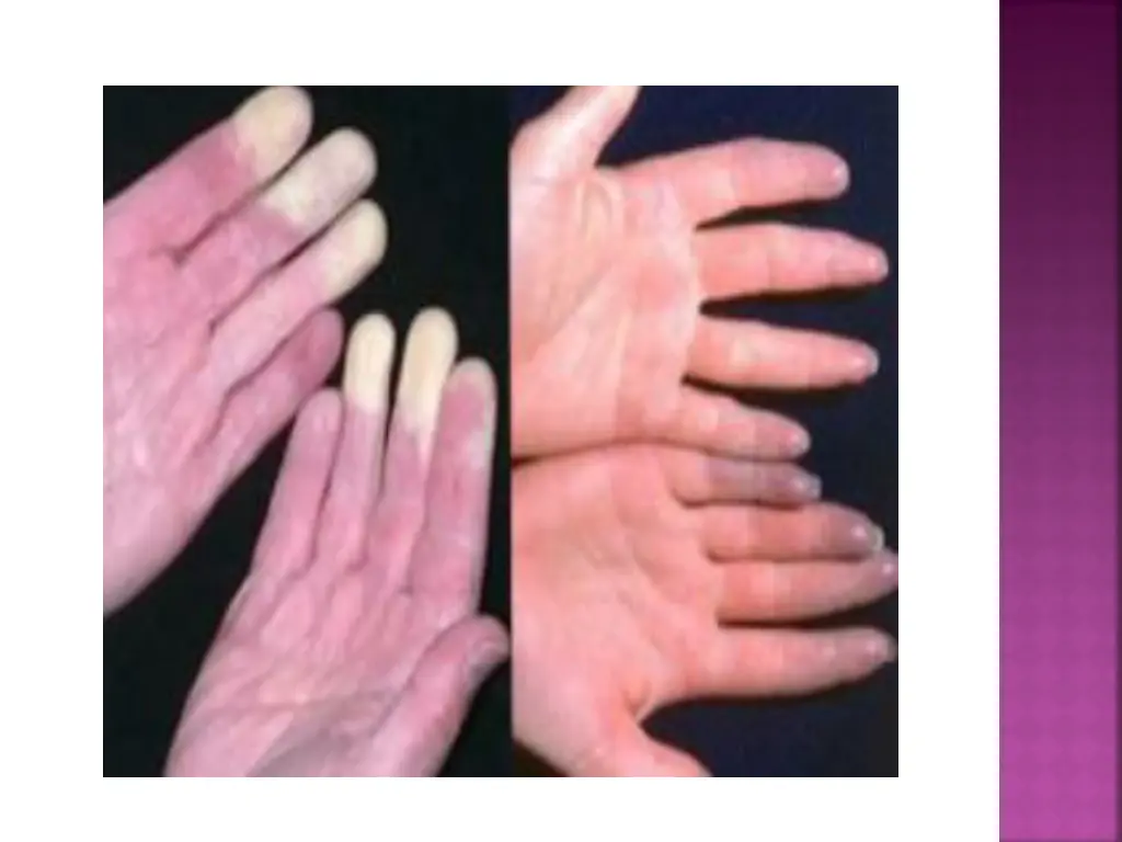 slide4