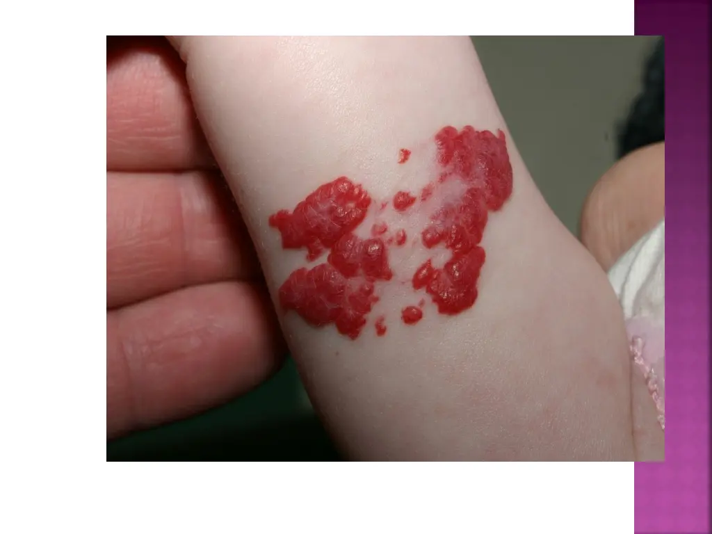 slide8