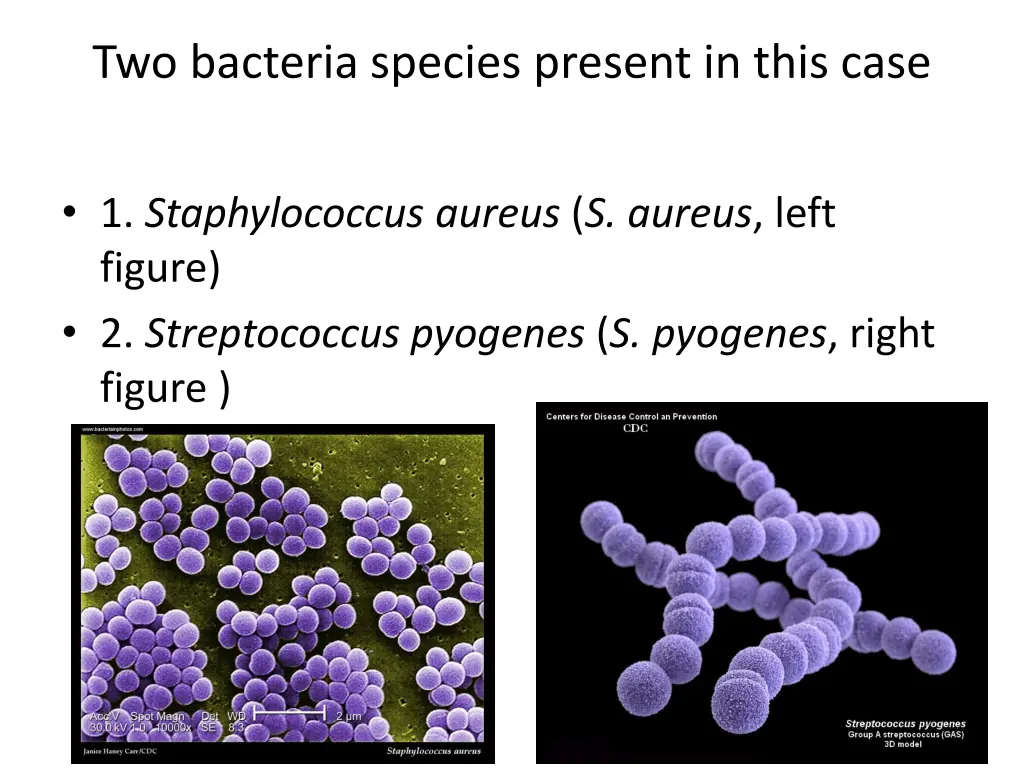 two bacteria species present in this case