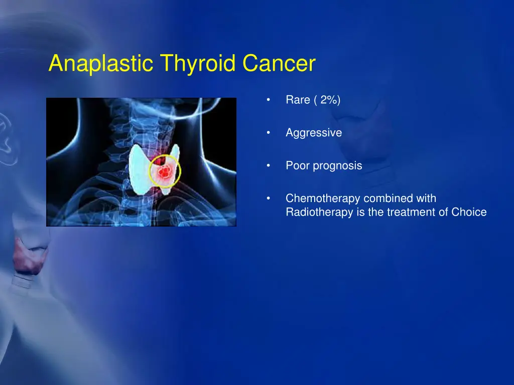 anaplastic thyroid cancer
