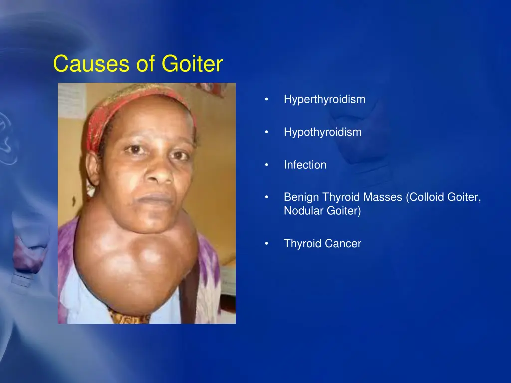 causes of goiter